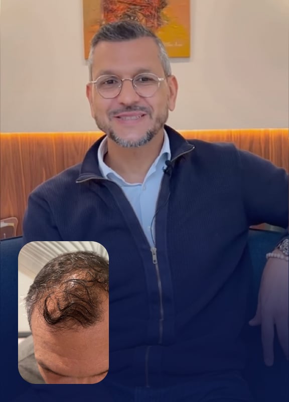 racine-carree-interview-greffe-cheveux-lotfi