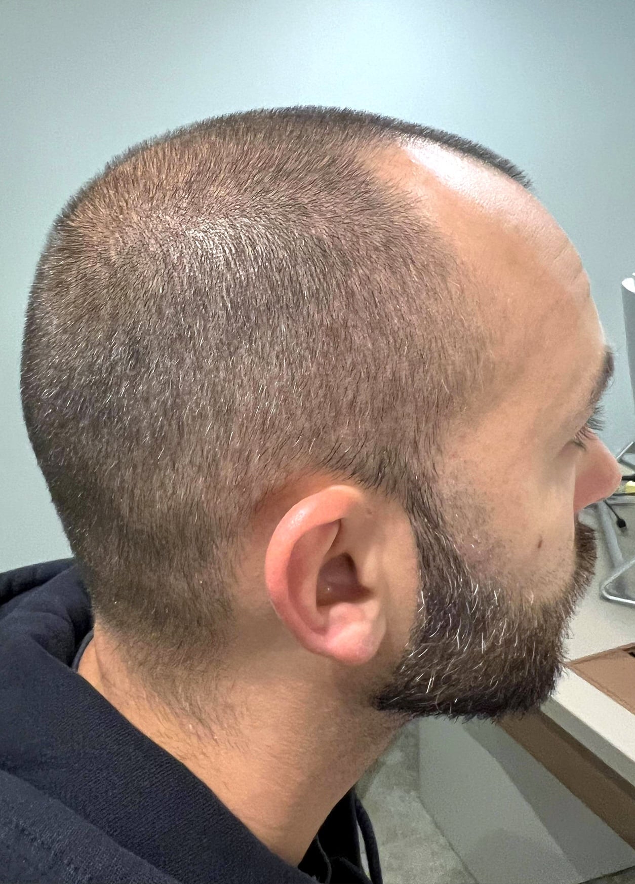 gaetan-avant-profil-1