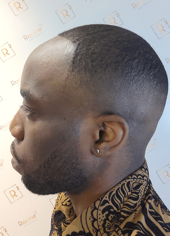 R2-Kevin-profil-avant