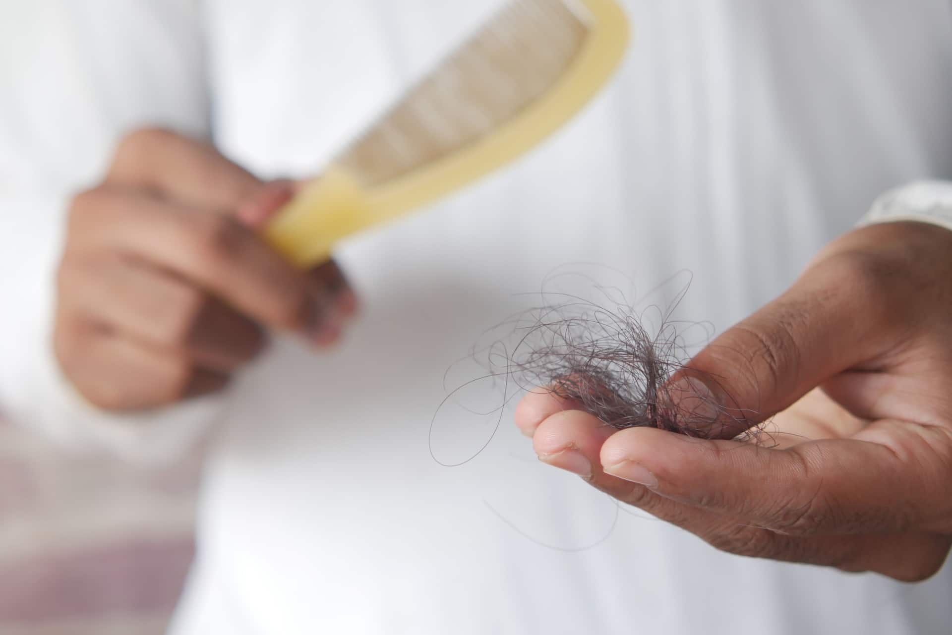 perte-de-cheveux-apres-un-regime-r2